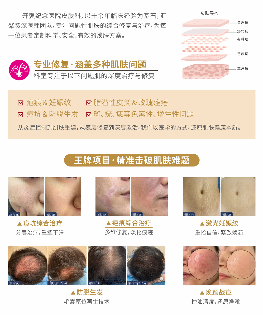 真实案例|42岁男士雄脱5-6级,3.5个月逆袭生发! 640 2ef00791